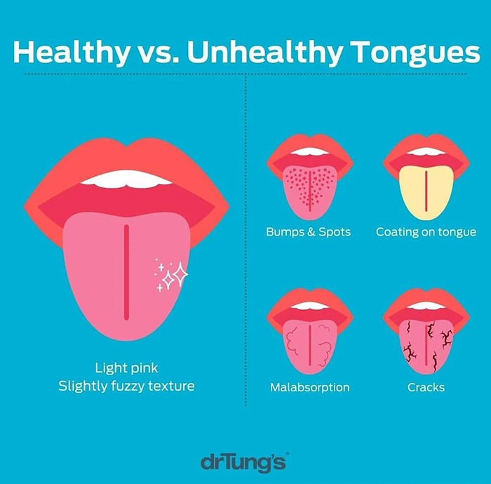 ที่ทำความสะอาดลิ้น DrTung's Tongue Cleaner 