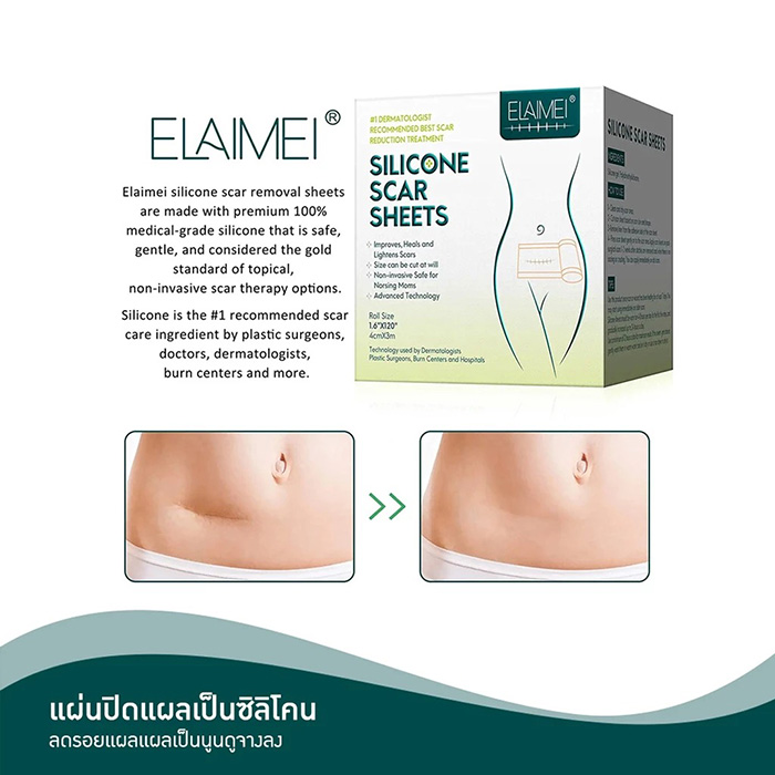 แผ่นแปะซิลิโคนลดรอยแผลเป็นนูน ELAIMEI Silicone Scar Sheets