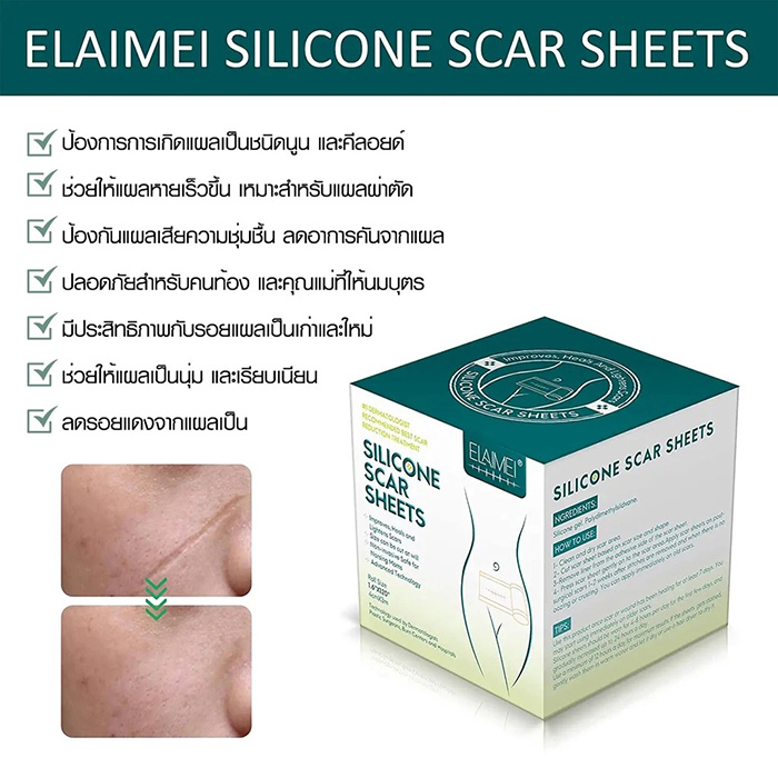 แผ่นแปะซิลิโคนลดรอยแผลเป็นนูน ELAIMEI Silicone Scar Sheets