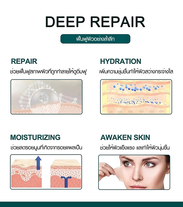 แผ่นแปะซิลิโคนลดรอยแผลเป็นนูน ELAIMEI Silicone Scar Sheets