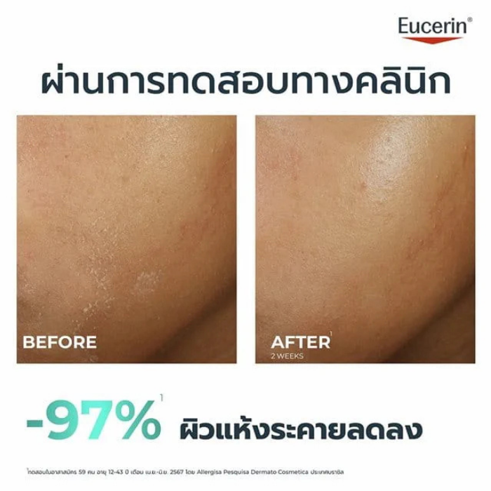 มอยส์เจอร์ไรเซอร์ Eucerin DermoPure Clinical Hydra Repair มอยส์เจอร์ไรเซอร์ Eucerin DermoPure Clinical Hydra Repair