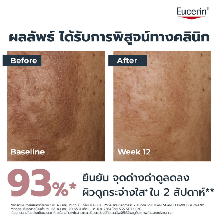 คอร์เรคเตอร์ลดรอยสิว Eucerin Spotless Brightening Spot Correcting คอร์เรคเตอร์ลดรอยสิว Eucerin Spotless Brightening Spot Correcting