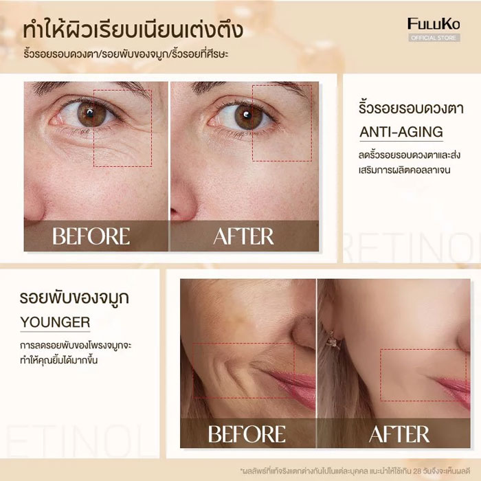 เซรั่ม Fuluko Retinol Anti-Aging Serum
