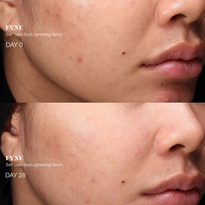 เซรั่ม FYNE SAP Dark Spot Lightening Serum