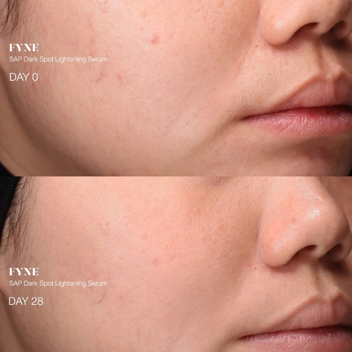 เซรั่ม FYNE SAP Dark Spot Lightening Serum