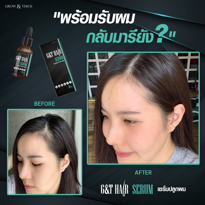 เซรั่มปลูกผม G&T Organic Hair Serum