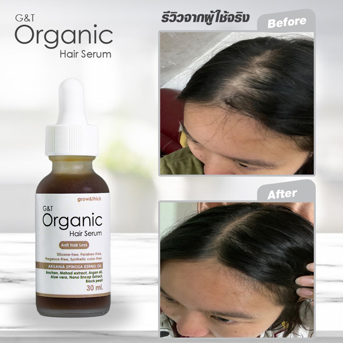 เซรั่มลดผมร่วง G&T Organic Hair Serum