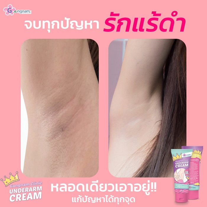 ครีมบำรุงผิวใต้วงแขน Gangnam Clinic Underarm Cream