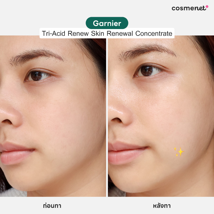 เซรั่ม Garnier Tri-Acid Renew Skin Renewal Concentrate
