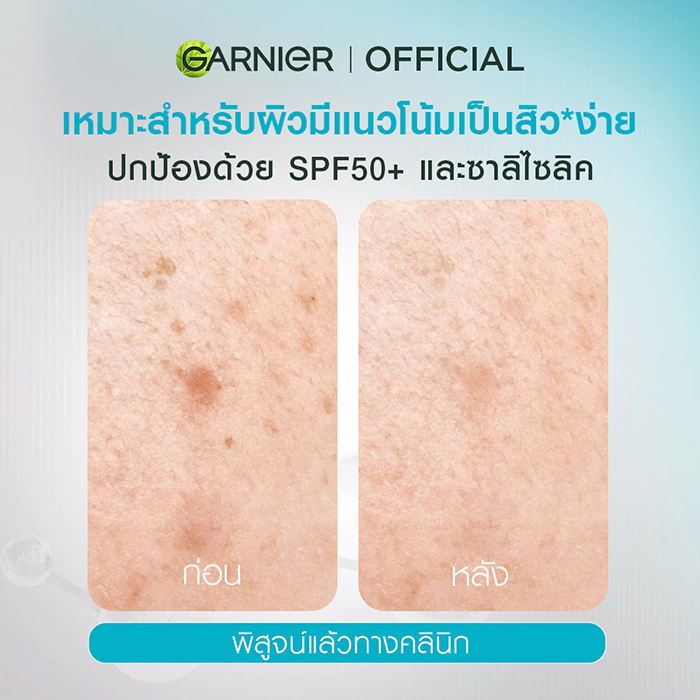 เซรั่มกันแดด Garnier Super UV Anti-Acne Serum Sunscreen