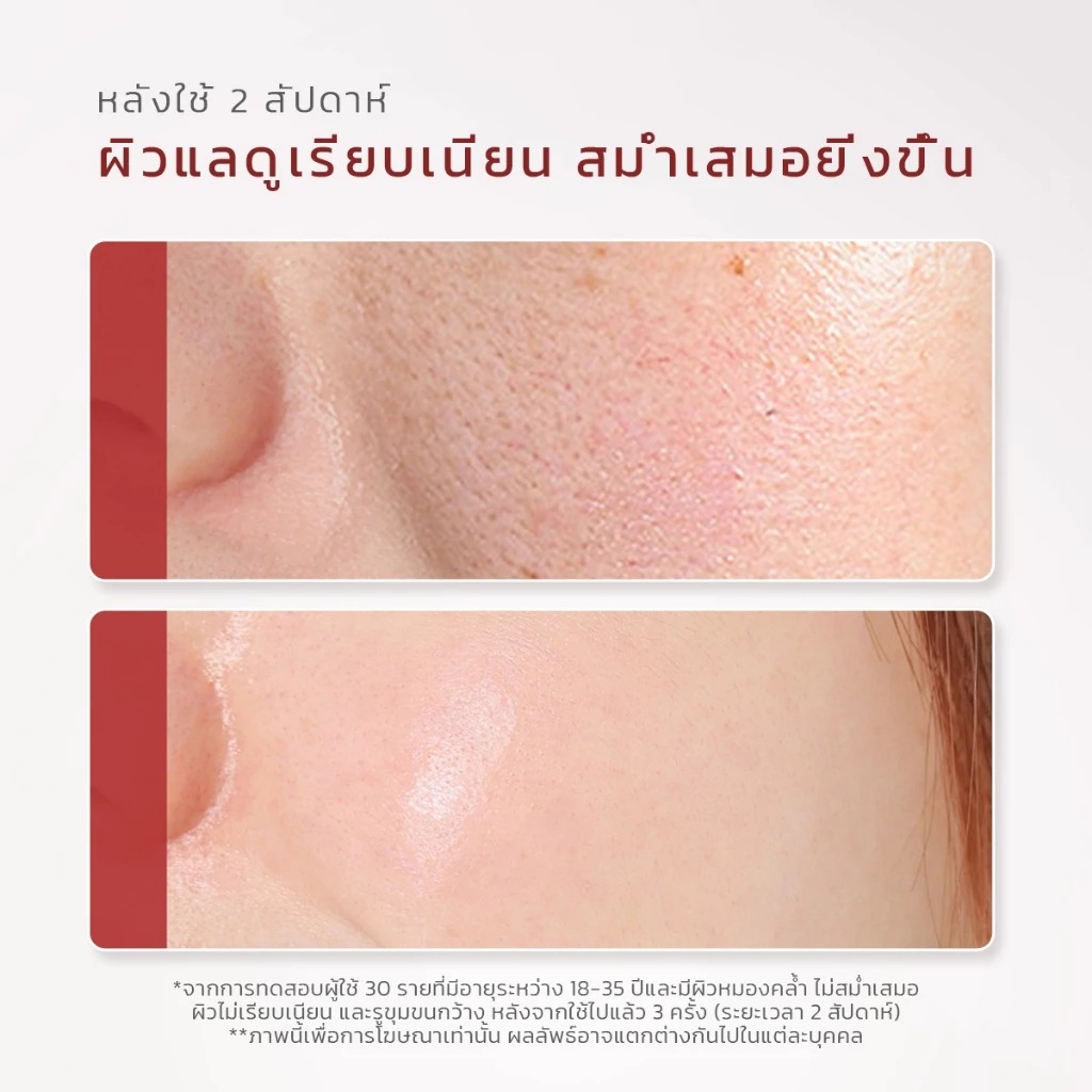 เซรั่มผลัดเซลล์ผิว Glad2Glow AHA BHA PHA Intensive Peeling Solution