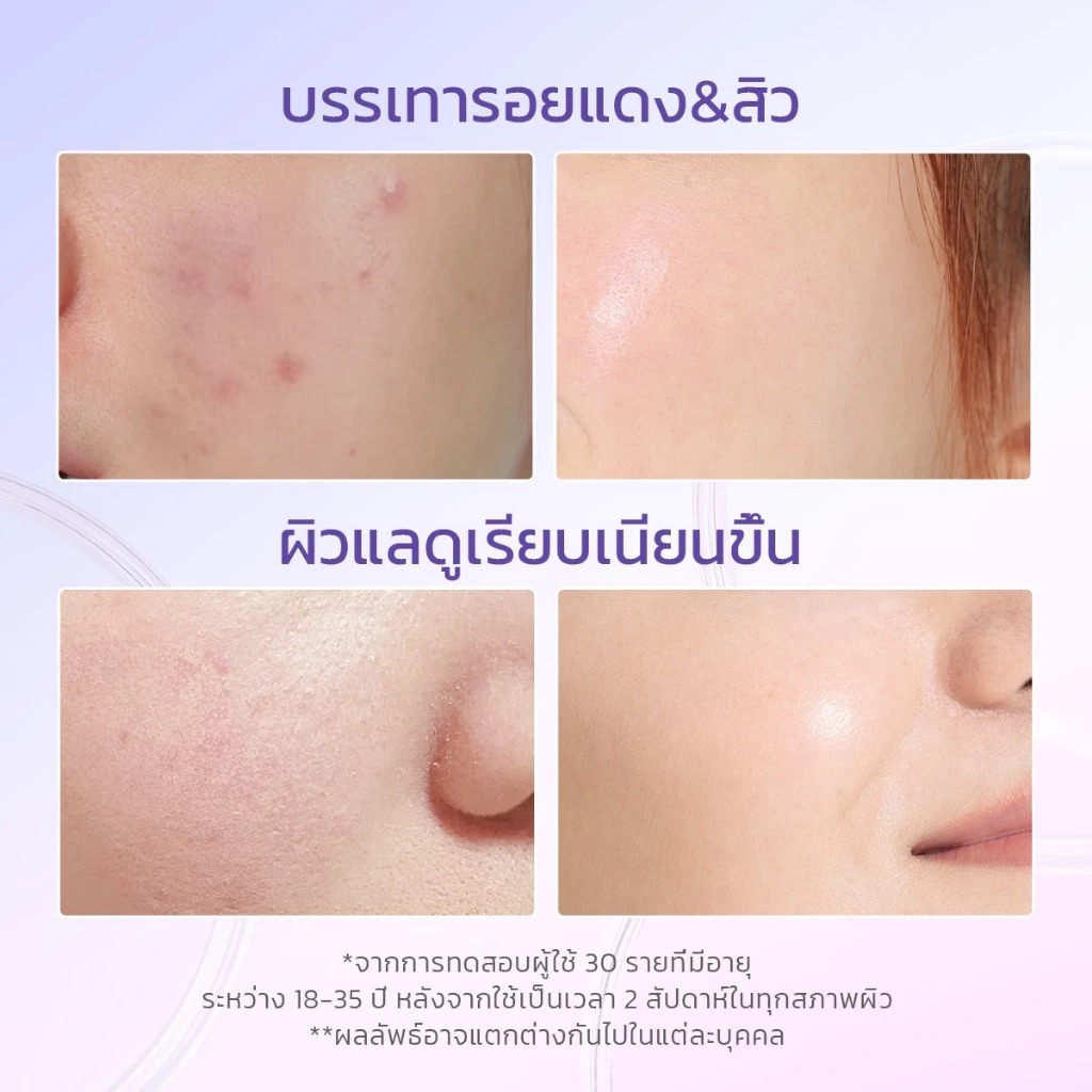 มอยเจอร์ไรเซอร์บลูเบอรี่ Glad2Glow Blueberry 5% Ceramide Moisturizer