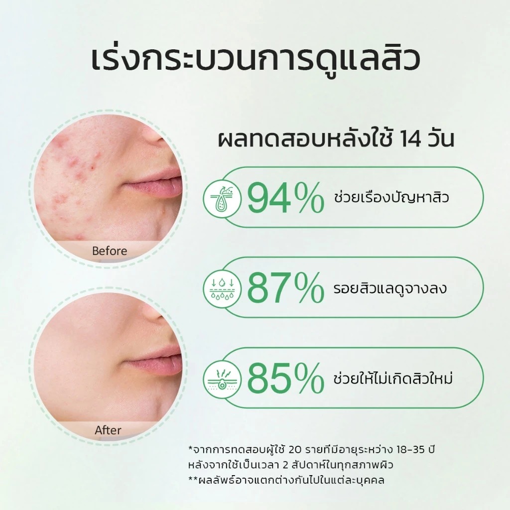 เซรั่มรักษาสิว Glad2Glow Centella Salicylic Acid Power Acne Serum