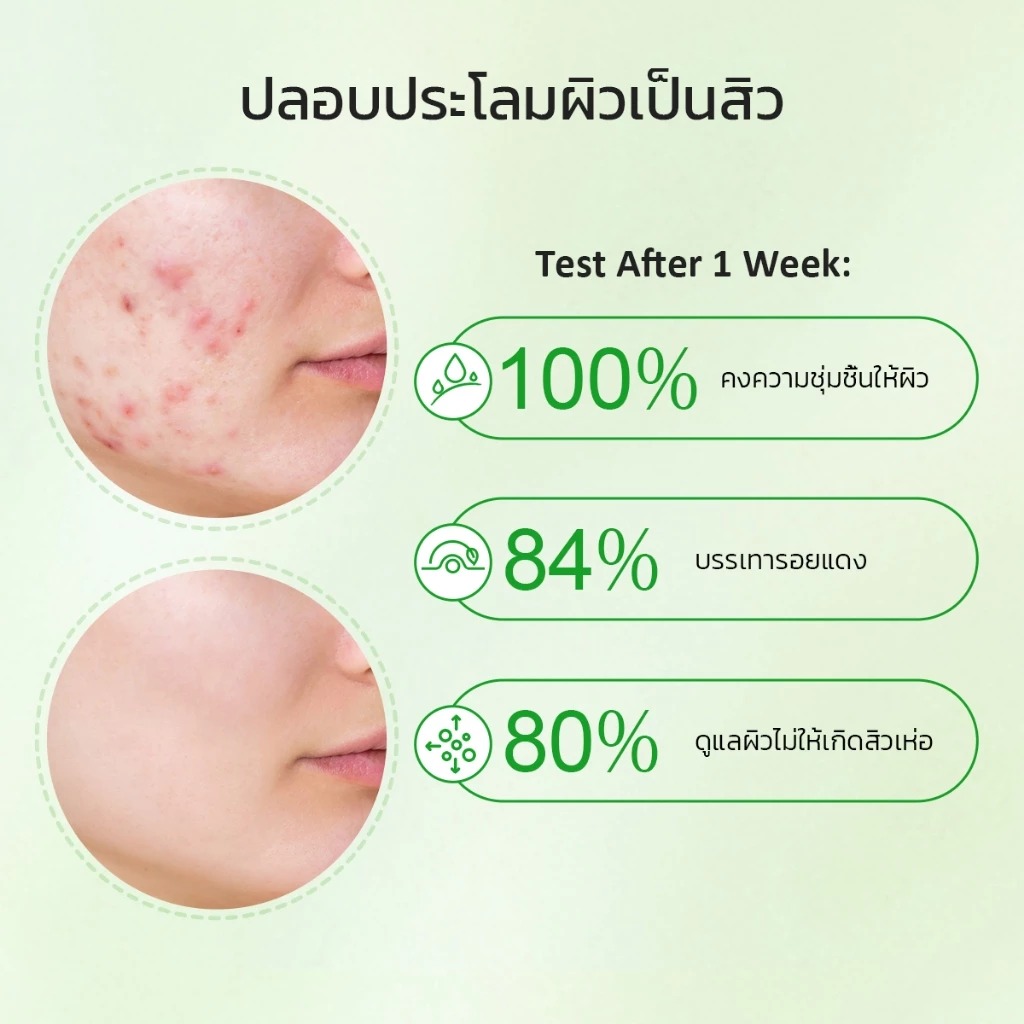 มอยเจอร์ไรเซอร์ Glad2Glows Centella Allantoin Soothing Gel Moisturizer