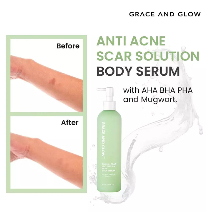 เซรั่มบำรุงผิวกาย Grace and Glow English Pear and Freesia Acne Body Serum