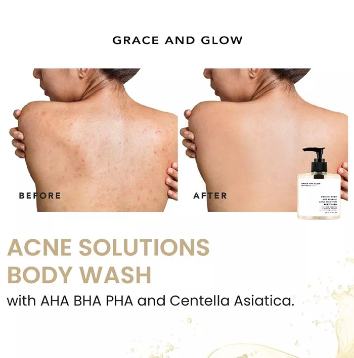 ครีมอาบน้ำ Grace and Glow English Pear and Freesia Acne Solution Body Wash