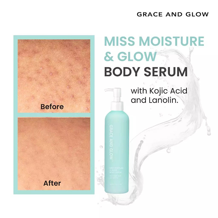 เซรั่มบำรุงผิวกาย Grace and Glow Miss Moisture & Glow Body Serum