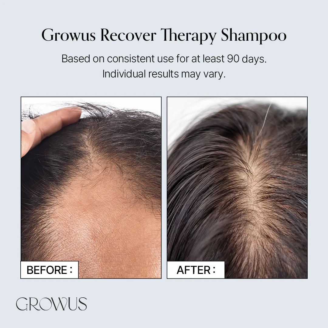 แชมพูทำความสะอาดเส้นผม GROWUS Recover Therapy Shampoo for Woman