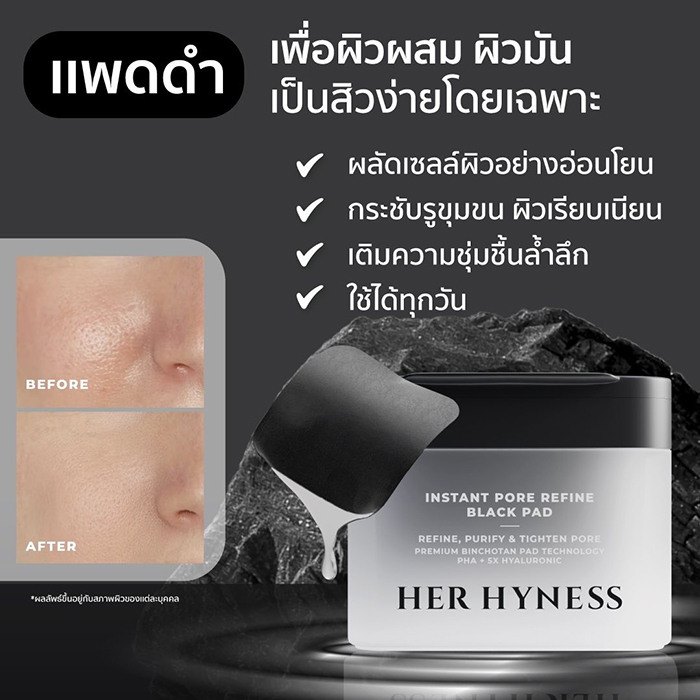 โทนเนอร์แพด HER HYNESS Instant Pore Refine Black Pad โทนเนอร์แพด HER HYNESS Instant Pore Refine Black Pad