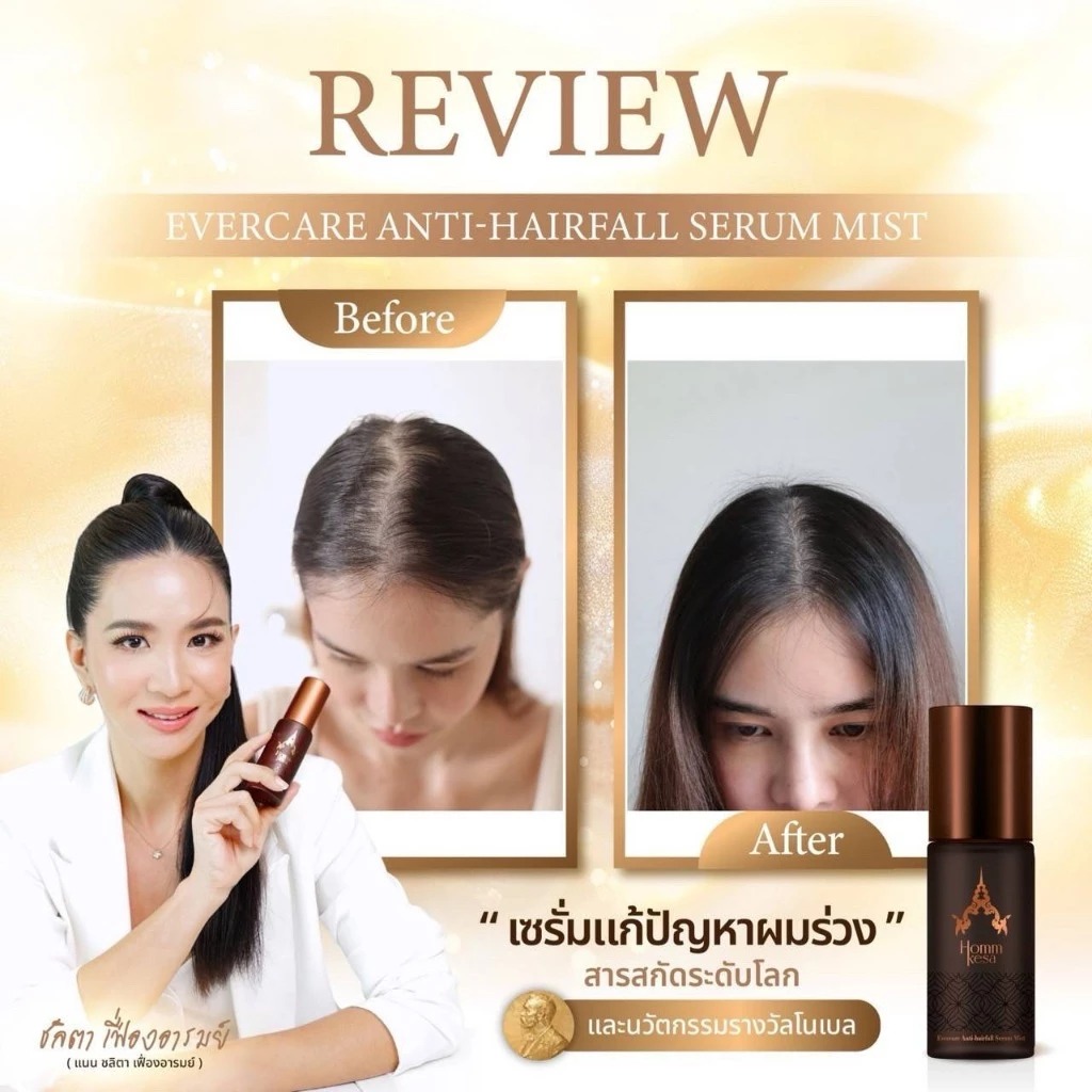 เซรั่มฟาร์มผม HommKesa Evercare Anti-Hairfall Serum Mist