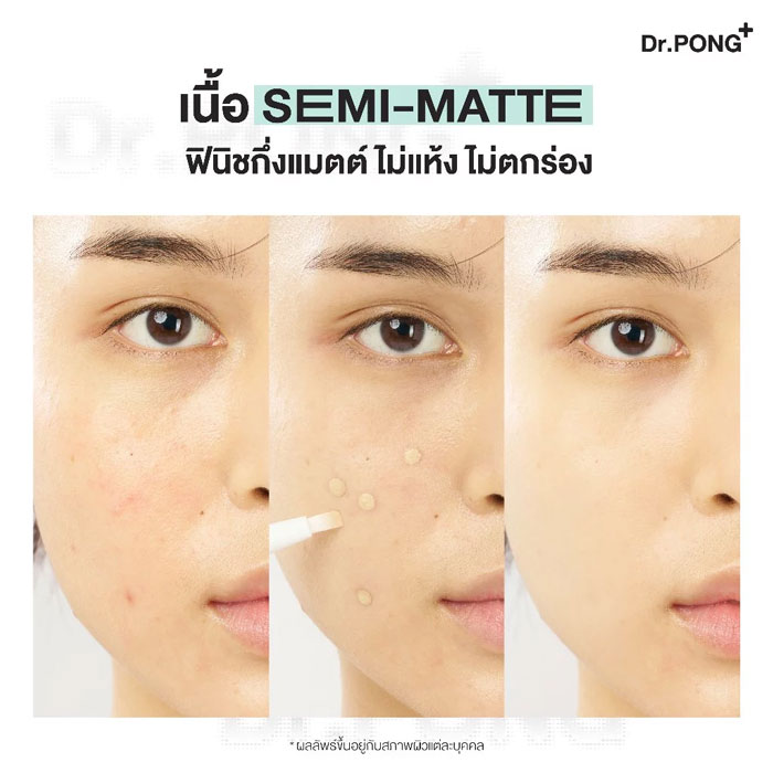 คอนซีลเลอร์ Dr.Pong Acne Ace Airy Brush Concealer