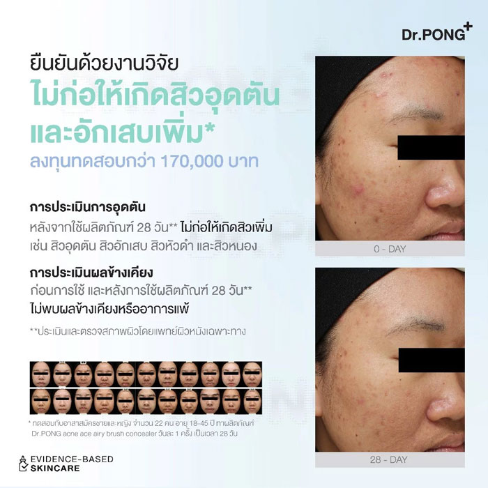 คอนซีลเลอร์ Dr.Pong Acne Ace Airy Brush Concealer