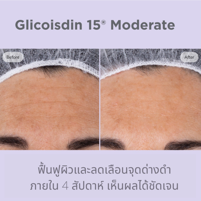 ครีมลดเลือนริ้วรอยจุดด่างดำ ISDIN Isdinceutics Glicoisdin 15 Moderate