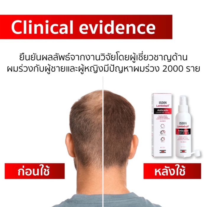 สเปรย์บำรุงรากผม ISDIN Lambdapil Anti-hair Loss Lotion Spray