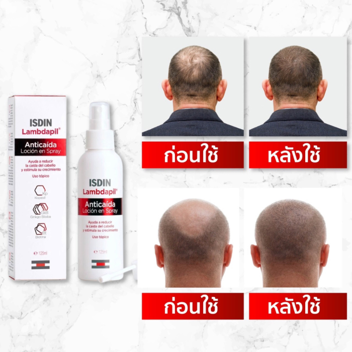 สเปรย์บำรุงรากผม ISDIN Lambdapil Anti-hair Loss Lotion Spray