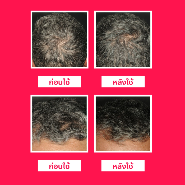 สเปรย์บำรุงรากผม ISDIN Lambdapil Anti-hair Loss Lotion Spray