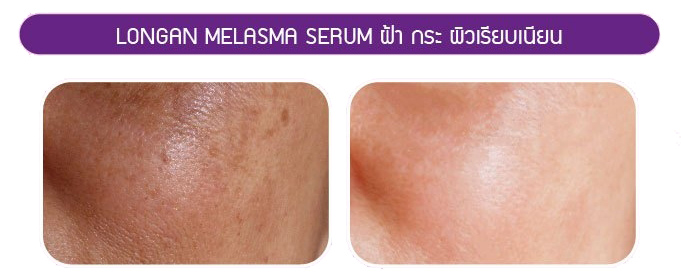 เซรั่ม ลำไย ลดฝ้า Jula's Herb Longan Melasma Serum