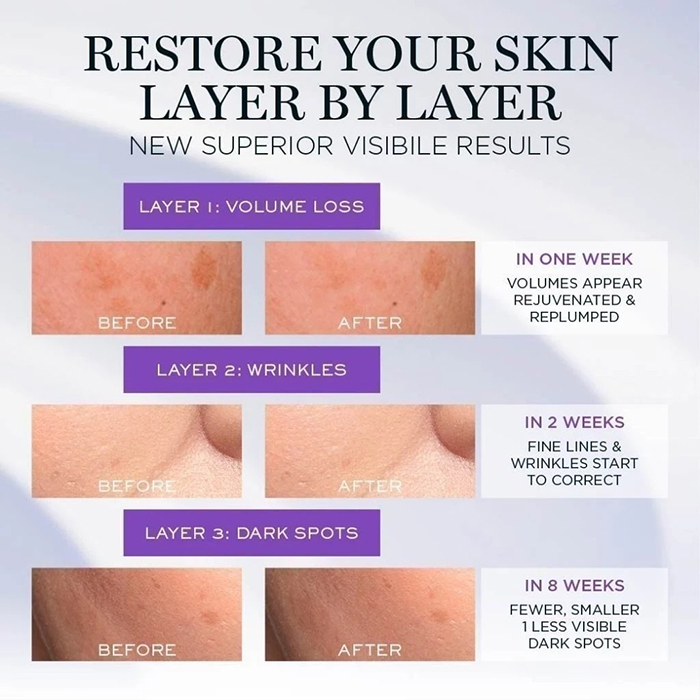 เซรั่ม LANCÔME Rénergie H.C.F. Triple Serum