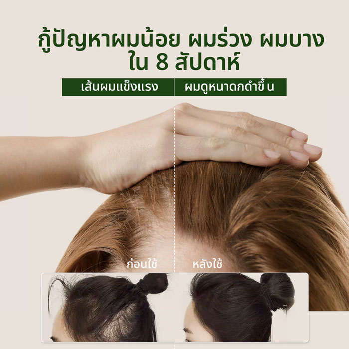 เซรั่มบำรุงหนังศรีษะ Lavojoy Hold Me Tight Pro Scalp Essence Spring Wonder