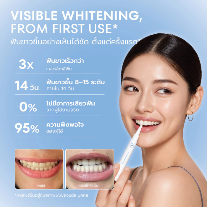 ปากกาฟอกฟันขาว Linee Teeth Whitening Pen