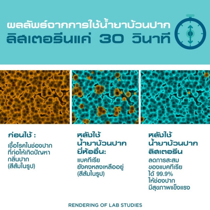 น้ำยาบ้วนปาก LISTERINE Mouthwash Healthy Bright น้ำยาบ้วนปาก LISTERINE Mouthwash Healthy Bright