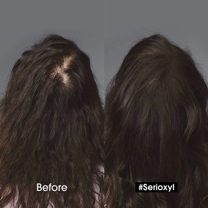  L'Oreal Professionnel SERIOXYL DENSER HAIR SERUM เซรั่มบำรุงเส้นผมและหนังศีรษะ ไม่ทิ้งความเหนอะ ผมเกิดใหม่ 1000 เส้นเมื่อใช้ติดต่อกัน 6 สัปดาห์