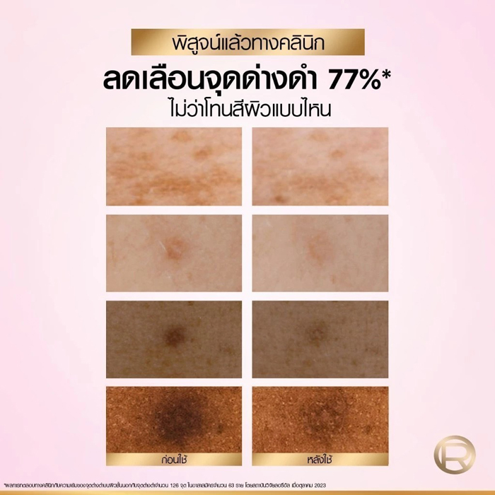 เซรั่ม L'Oreal Paris Glycolic Bright Anti-Dark Spot Brightening Serum