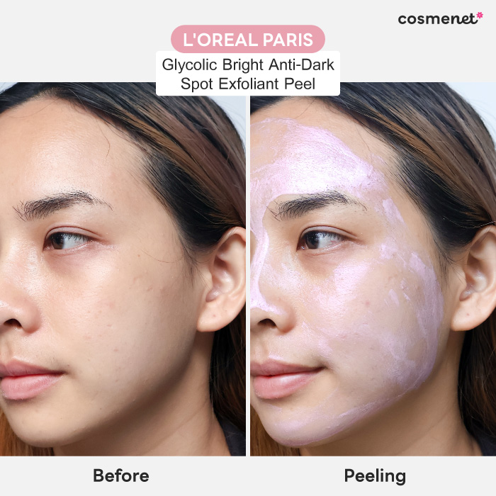 พิลลิ่งมาส์ก L'Oréal Paris Glycolic Bright Anti-Dark Spot Exfoliant Peel