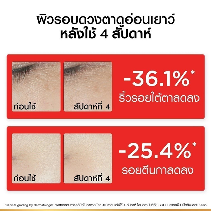 อายครีม L’Oréal Paris Revitalift Clinical Grade Advanced Anti-Wrinkle Firming Eye Cream