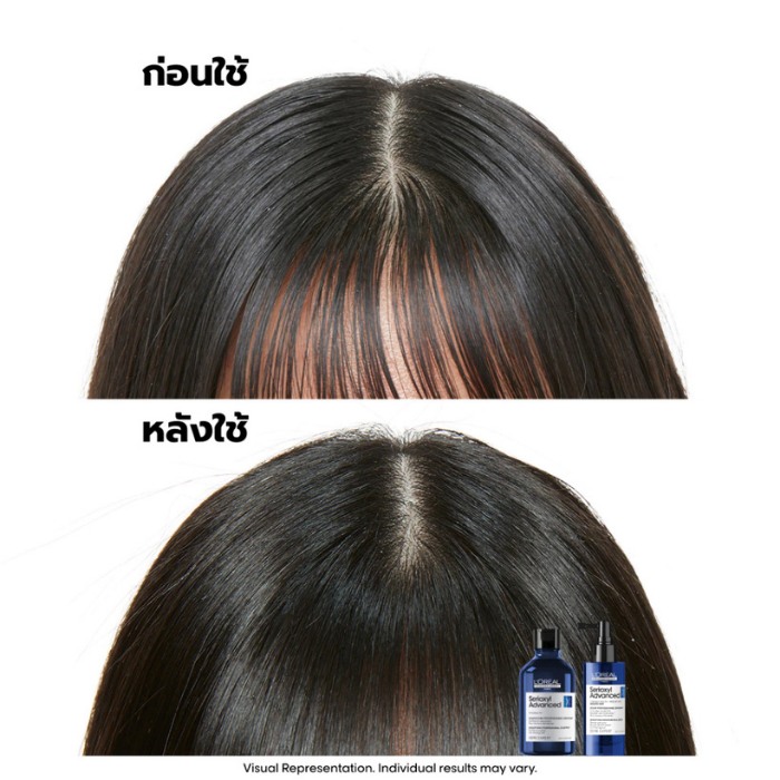 เซรั่มปลุกผม L'OREAL PARIS Serie Expert Serioxyl Density Serum เซรั่มปลุกผม L'OREAL PARIS Serie Expert Serioxyl Density Serum