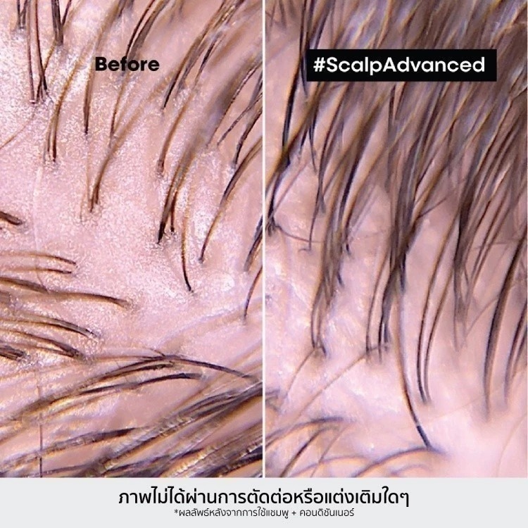 ครีมหมักผม L'OREAL PARIS Professionnel New Serie Expert Scalp Advanced Anti-Oiliness Clay