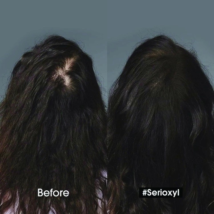 แชมพู L'OREAL PARIS Professionnel New Serie Expert Serioxyl Advanced Densifying Shampoo