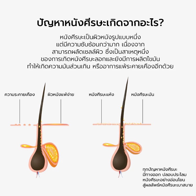 แชมพู L'OREAL PARIS Professionnel New Serie Expert Serioxyl Advanced Densifying Shampoo