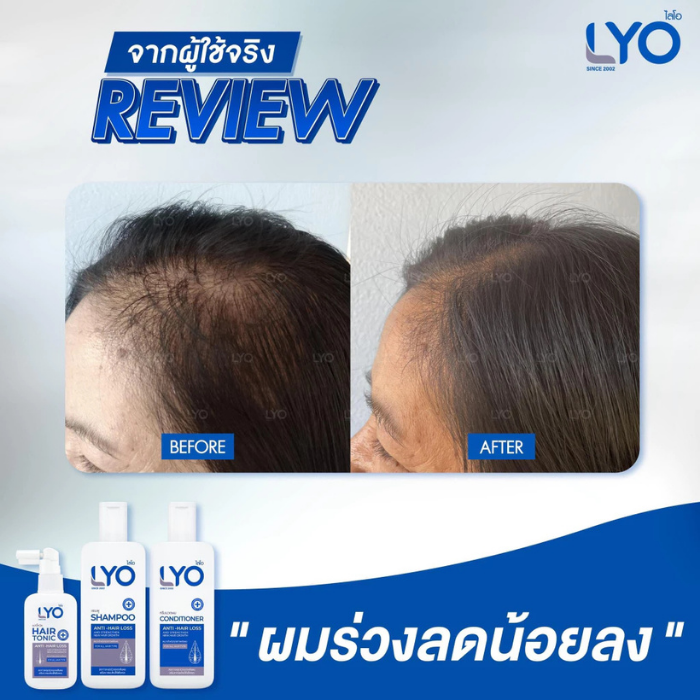 เซรั่มบำรุงผม LYO Hair Tonic