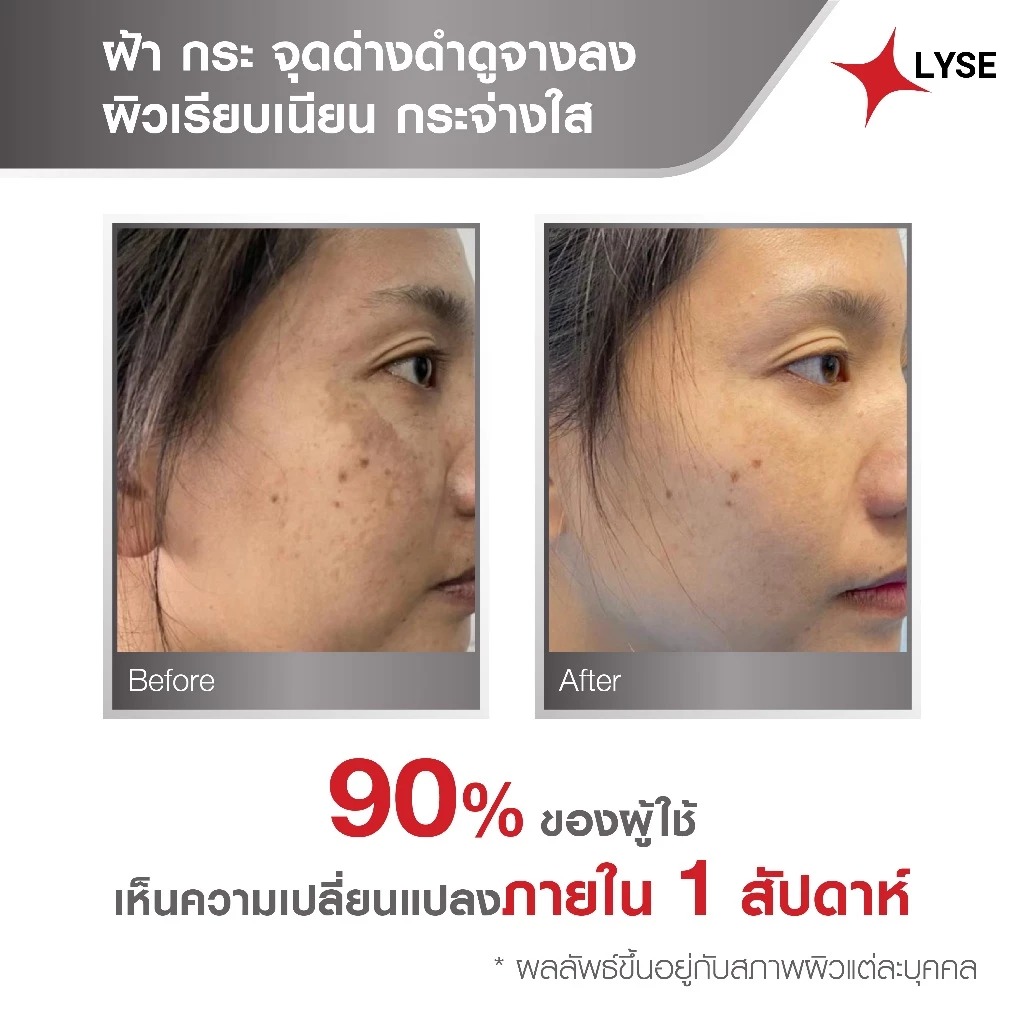 เซรั่มบำรุงผิว LYSE Anti Melasma Plus Super Serum