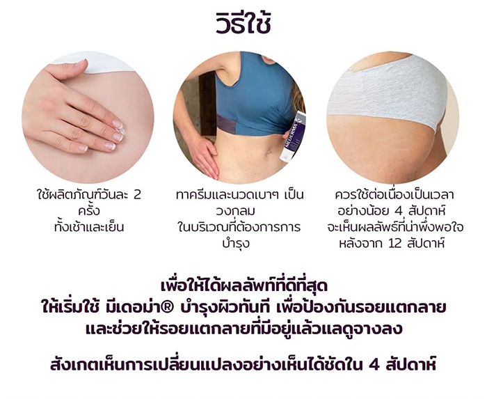 ครีมบำรุงผิวเพื่อป้องกันรอยแตกลาย Mederma  Stretch Marks