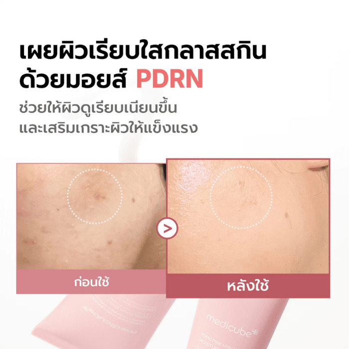ครีมบำรุงผิวหน้า MEDICUBE PDRN Pink Hyaluronic Moisturizing Cream ครีมบำรุงผิวหน้า MEDICUBE PDRN Pink Hyaluronic Moisturizing Cream
