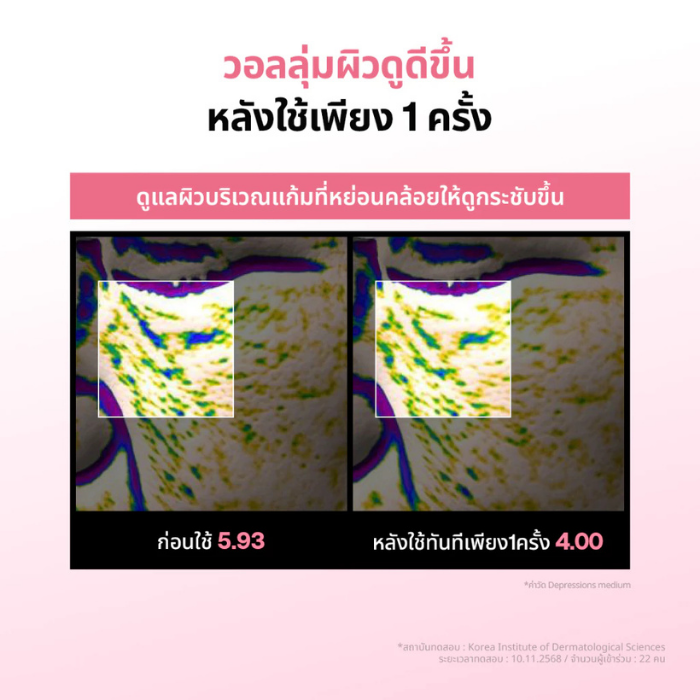 เซรั่มคอลลาเจน MEDIHEAL COLLAGEN Firming Volume Serum EX เซรั่มคอลลาเจน MEDIHEAL COLLAGEN Firming Volume Serum EX