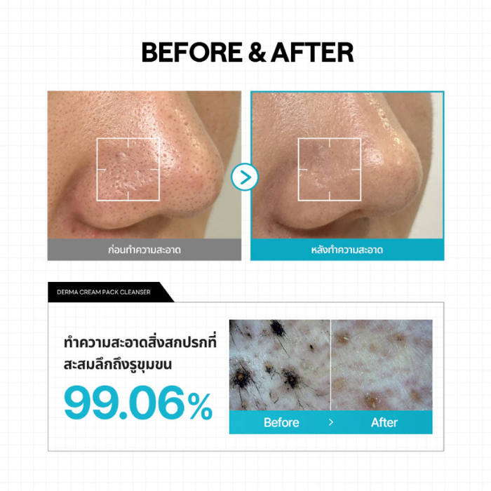 มาสก์&คลีนเซอร์ MEDIHEAL Derma Cream Pack Cleanser มาสก์&คลีนเซอร์ MEDIHEAL Derma Cream Pack Cleanser