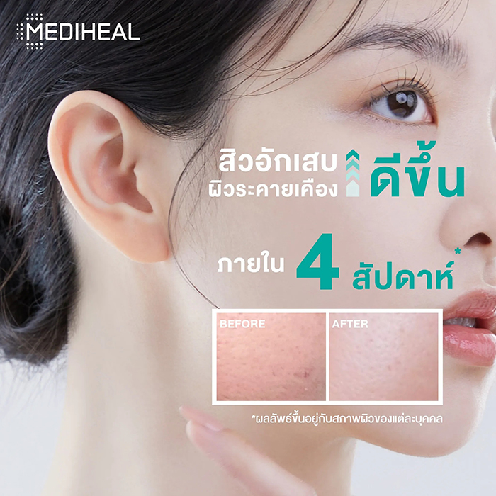 โทนเนอร์แพด Mediheal Madecassoside Blemish Pad